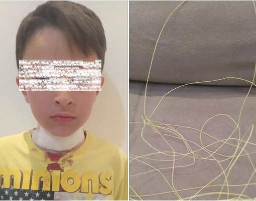 Botucatu: Menino de 8 anos tem o pescoço cortado por linha de pipa com cerol. “Pipa é para brincar, não para matar”, desabafa a mãe