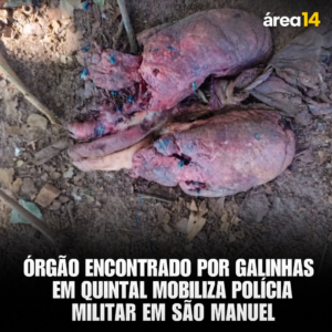Área 14